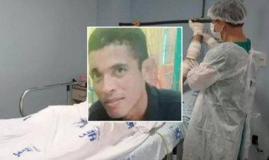 Homem queimado pela esposa morre após 10 dias internado em Ji-Paraná