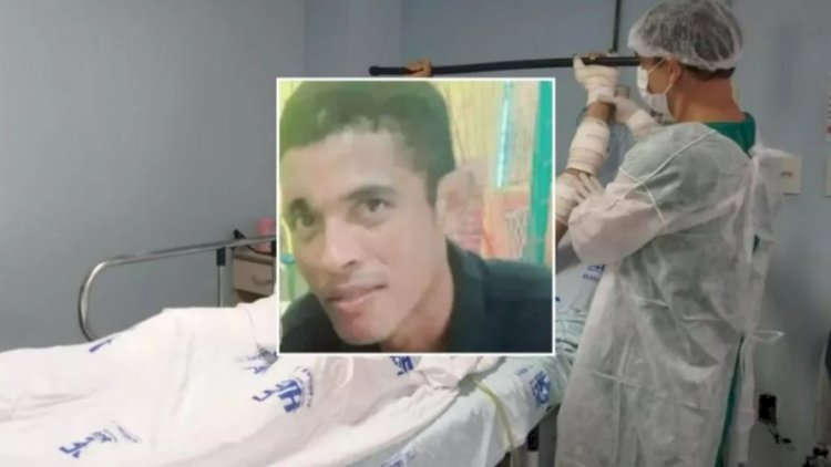 Homem queimado pela esposa morre após 10 dias internado em Ji-Paraná
